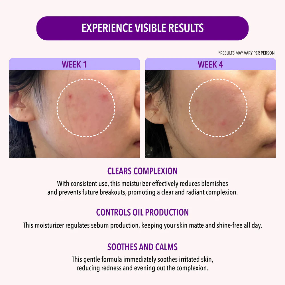 MOIRA 10% Niacinamide Oil Control Moisturizer