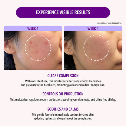 MOIRA 10% Niacinamide Oil Control Moisturizer