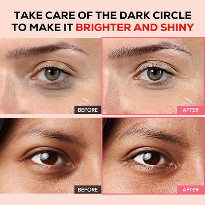 Olivia & Allison Dark Circle Corrector Eye Care